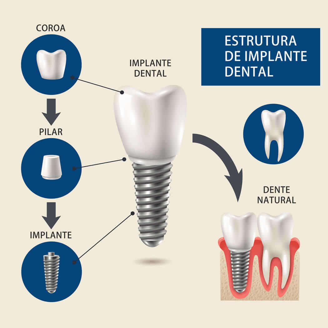 Consultório de Implantes e Aparelhos Dentários