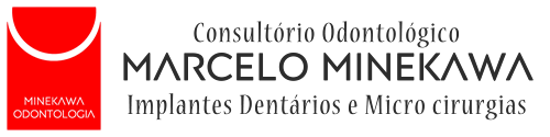 Implantes Dentais e Microcirurgias Bucais em Campinas