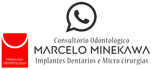 Implantes Dentais e Microcirurgias Bucais em Campinas